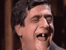 Hillbilly Teeth